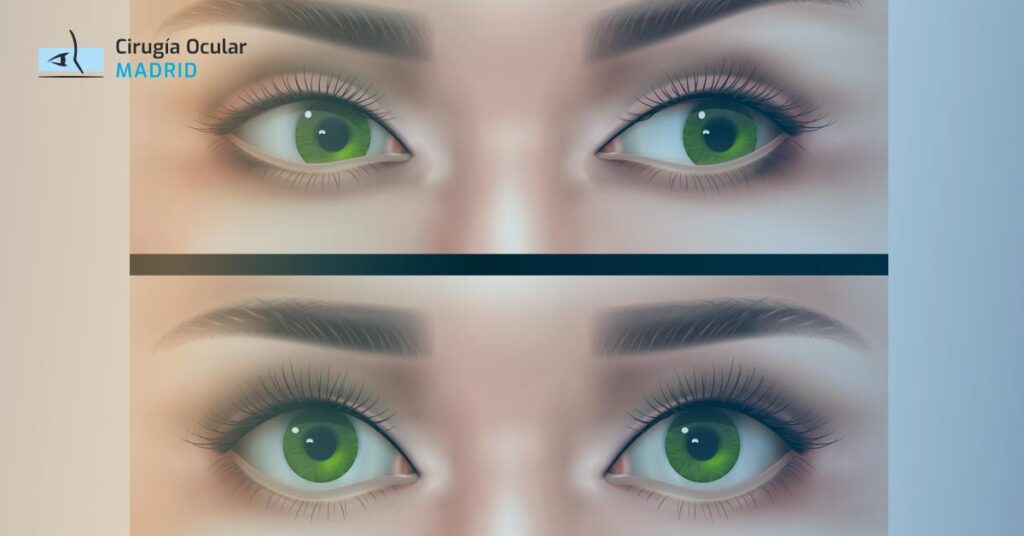 Tipos de ojos: ¡Conoce las formas y características que los hacen únicos!