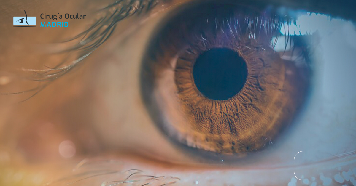 Tic o temblor en el ojo: Causas, tratamiento y soluciones