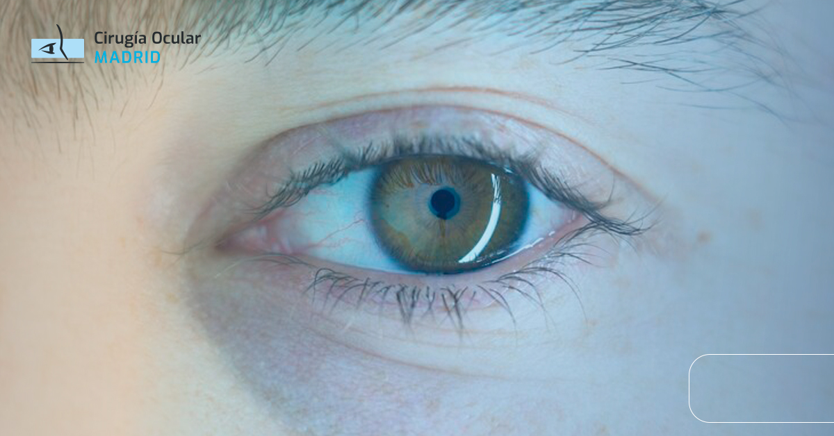 Heridas en el ojo: Tipos, síntomas y tratamientos