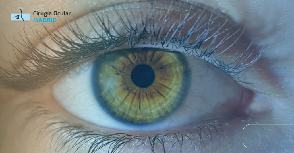 Degeneración macular asociada a la edad seca: síntomas y tratamientos