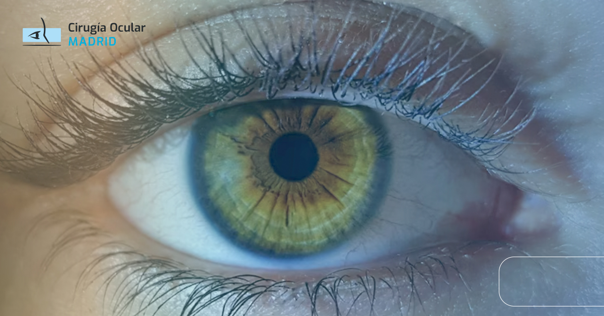 Degeneración macular asociada a la edad seca: síntomas y tratamientos