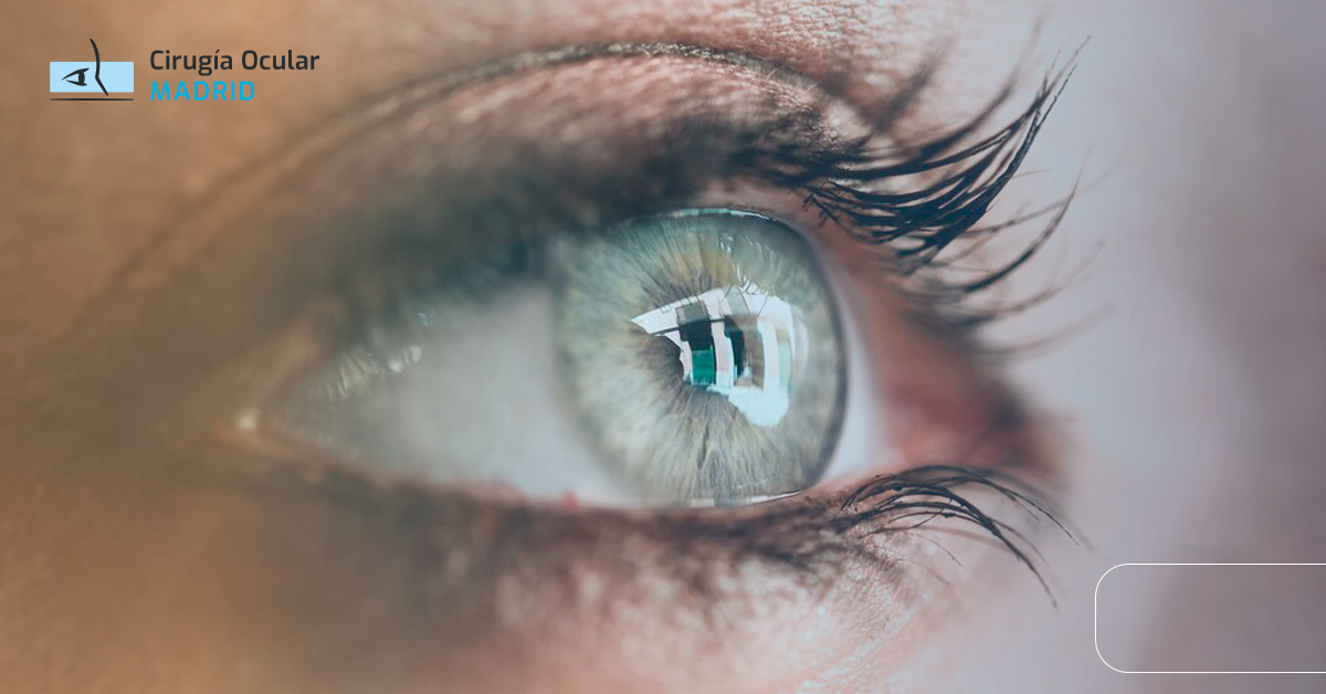 Problemas frecuentes con lentes intraoculares tras una cirugía