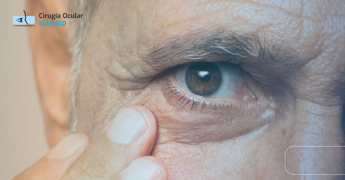 ¿Sientes arena en los ojos? Conoce sus causas y tratamientos