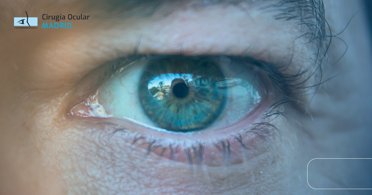 Cuerpo Ciliar: Definición, Funciones y Patologías Asociadas