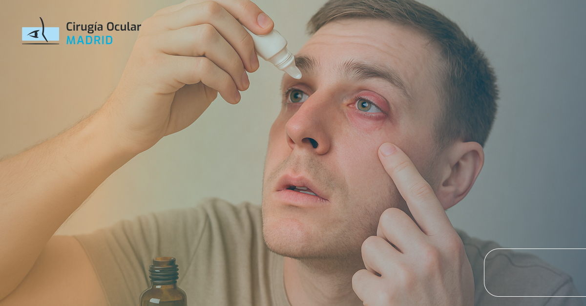 personas con conjuntivitis virica aplicandose tratamiento