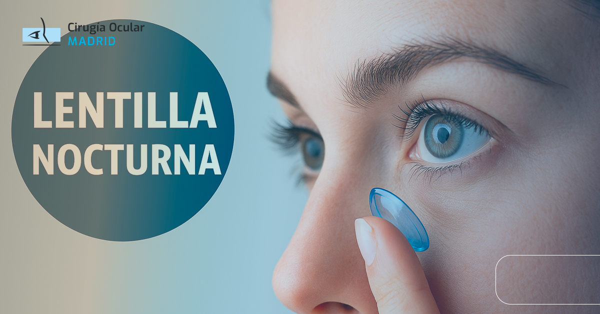 Lentillas nocturnas: la ortoqueratología como alternativa no quirúrgica