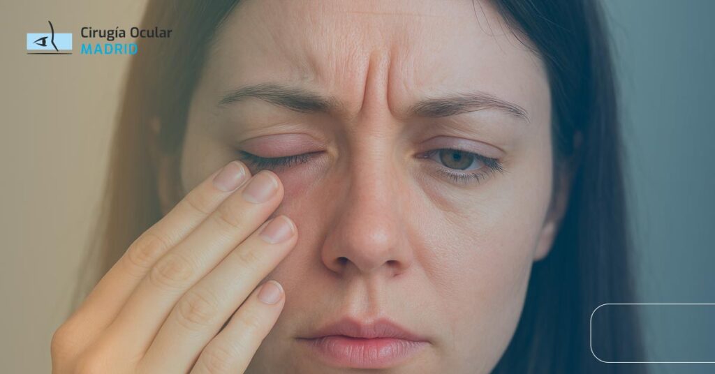 Escozor en el ojo: causas, síntomas y tratamientos efectivos