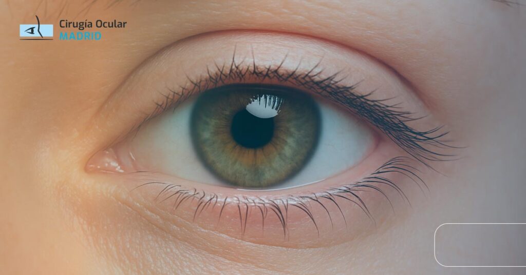 Borde Palpebral: Limpieza y Cuidado de Párpados