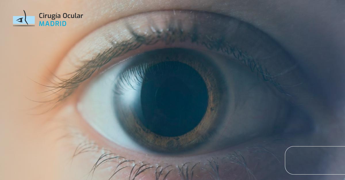 Pupilas dilatadas: causas y cuándo preocuparse